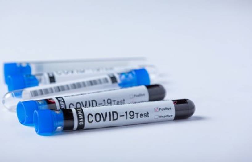 DIM Centros de Salud  comenzó a realizar los Test Rápidos de Antígenos COVID-19
