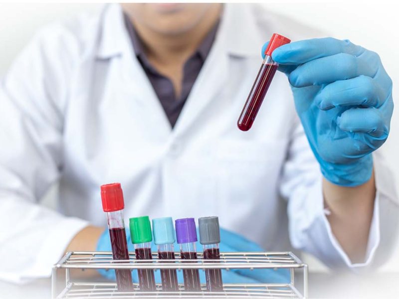 Diagnóstico de anemia: el rol clave del laboratorio y un enfoque multidisciplinario