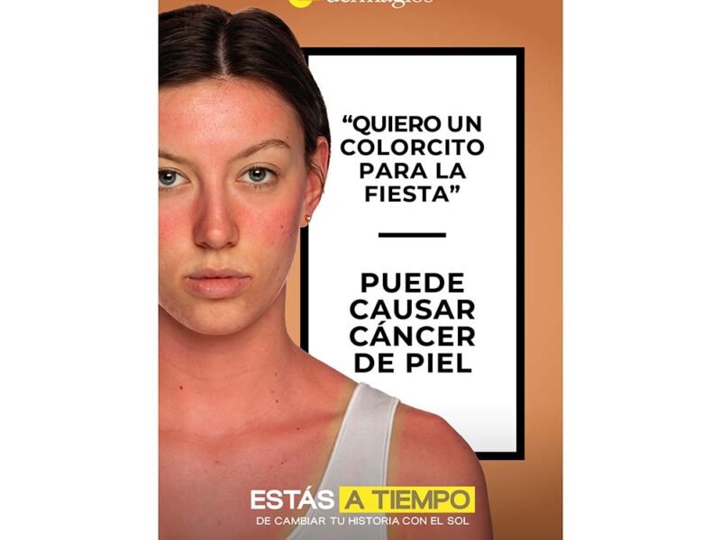 Dermaglós Solar reafirma su mensaje de prevención con la campaña “Estás a tiempo de cambiar tu historia con el sol”