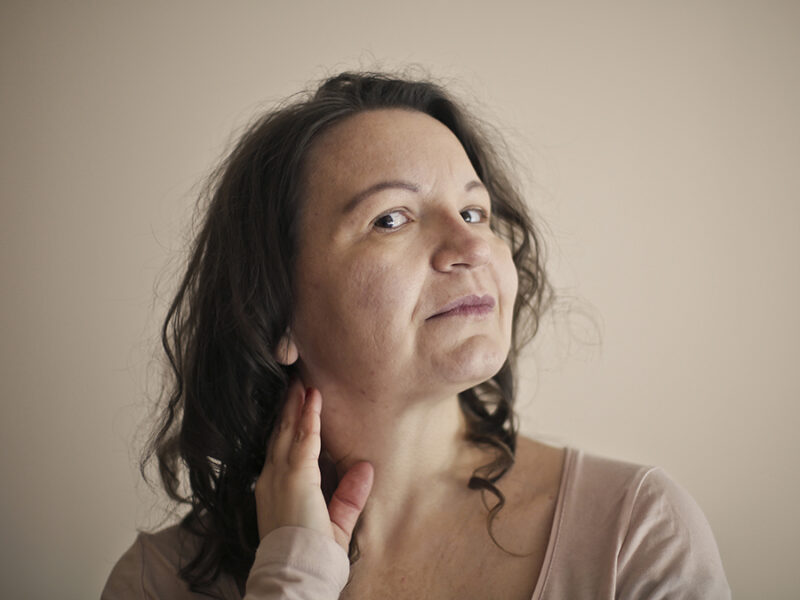 Acné en la mujer adulta: cuando el problema no es solo la piel