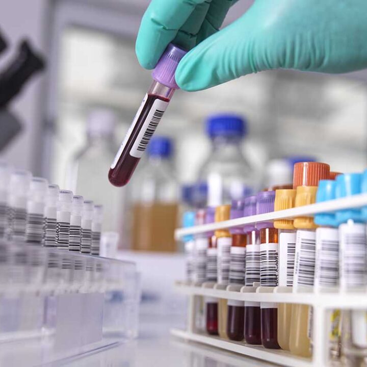 Hasta 90 millones de personas en el mundo son portadoras del gen de una enfermedad hereditaria aún poco conocida[1]