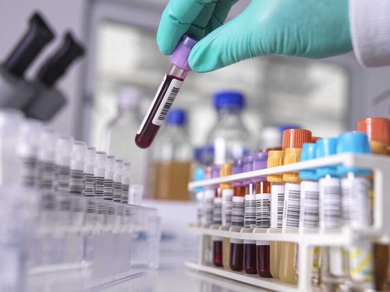 Hasta 90 millones de personas en el mundo son portadoras del gen de una enfermedad hereditaria aún poco conocida[1]
