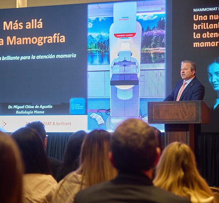 Salud femenina: llega a la Argentina un mamógrafo con tecnología 3D que mejora la detección del cáncer de mama