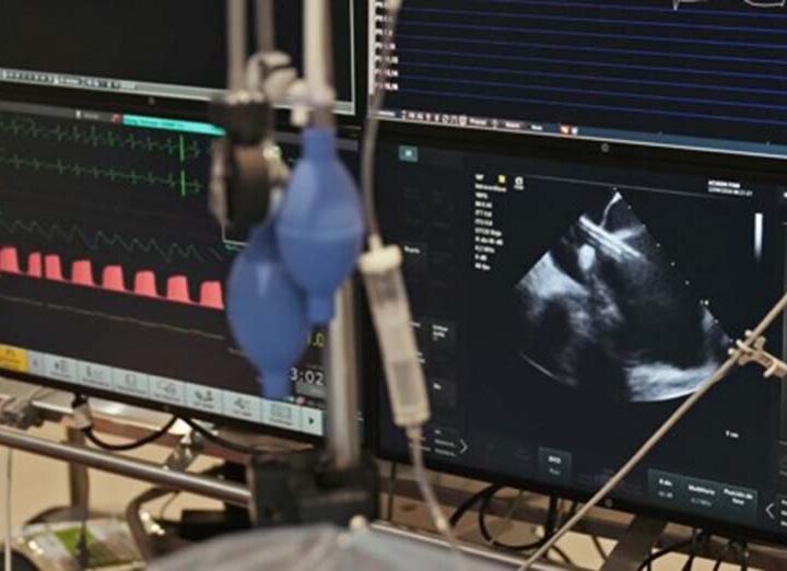 ICBA realiza el primer procedimiento con PulseSelect™ en Argentina y refuerza su liderazgo regional en innovación cardiovascular