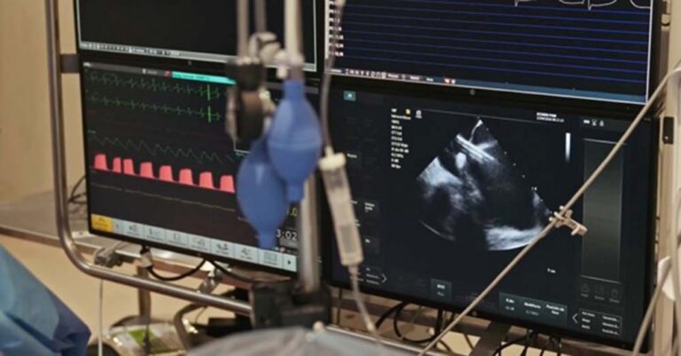ICBA realiza el primer procedimiento con PulseSelect™ en Argentina y refuerza su liderazgo regional en innovación cardiovascular