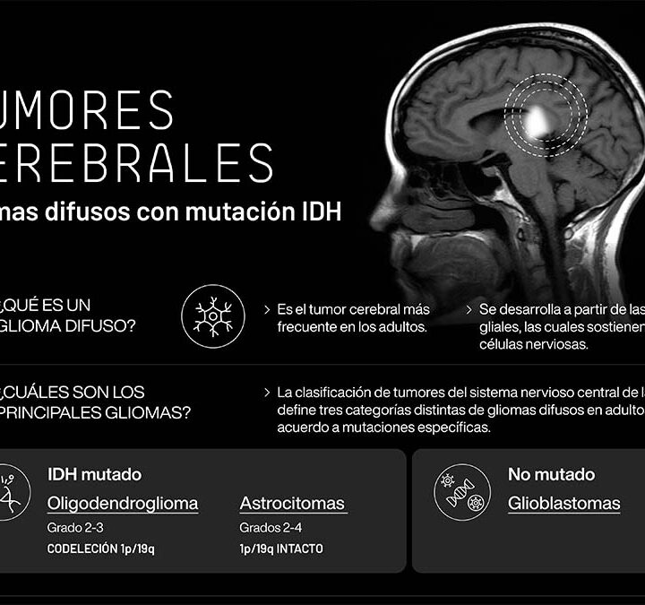 “Esto es un Glioma”: Lanzan una campaña de concienciación para transformar la realidad de los pacientes con tumores cerebrales en Argentina