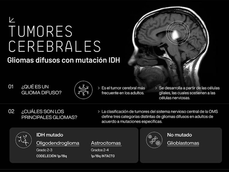 “Esto es un Glioma”: Lanzan una campaña de concienciación para transformar la realidad de los pacientes con tumores cerebrales en Argentina