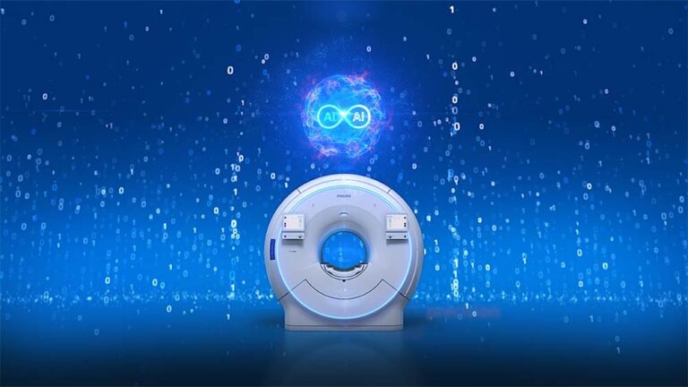 Philips presenta SmartSpeed Precise, una nueva generación de tecnología de resonancia magnética impulsada por IA