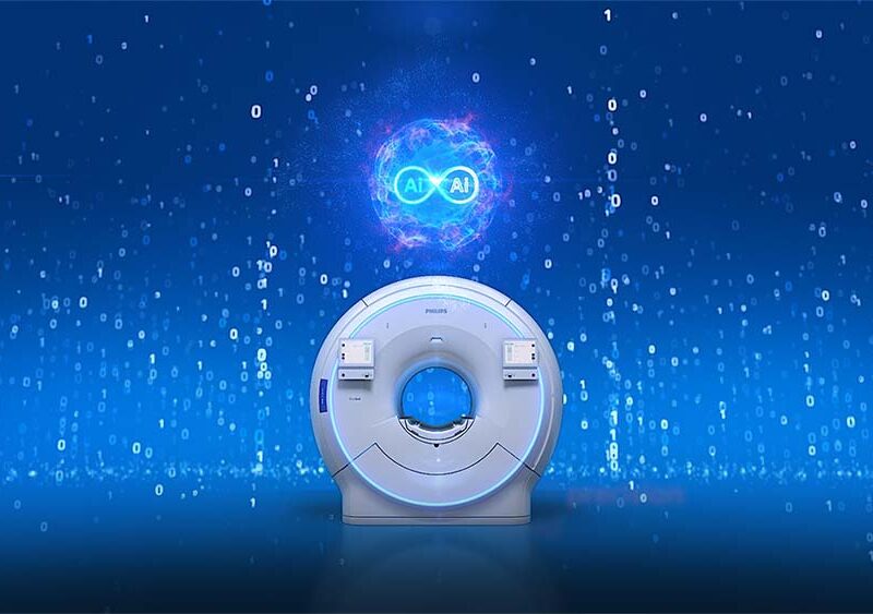 Philips presenta SmartSpeed Precise, una nueva generación de tecnología de resonancia magnética impulsada por IA