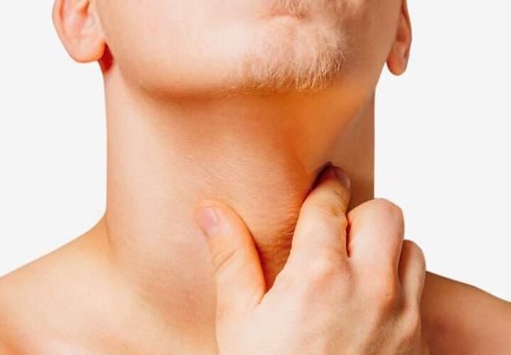 Linfoma: la importancia de un diagnóstico oportuno y un acompañamiento integral