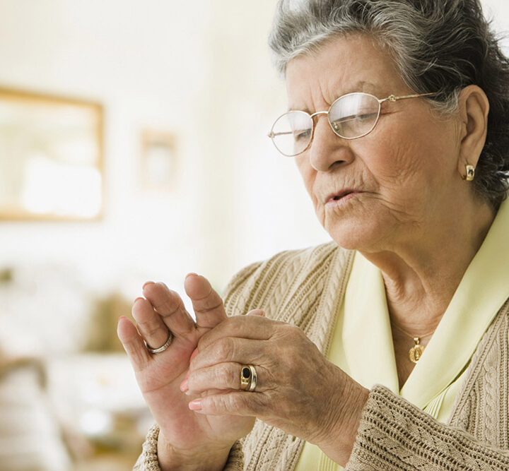 Artritis psoriásica: cuando las señales no se conectan, el diagnóstico puede llegar tarde