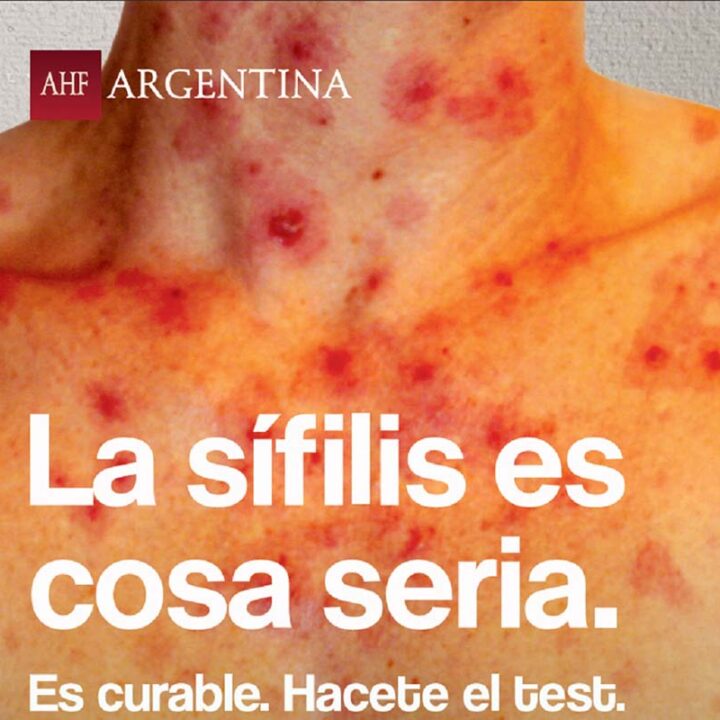 Sífilis: los diagnósticos en mujeres aumentaron 26% en los centros de AHF Argentina